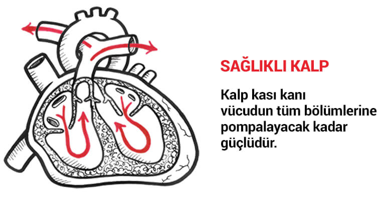 Sağlıklı kalp