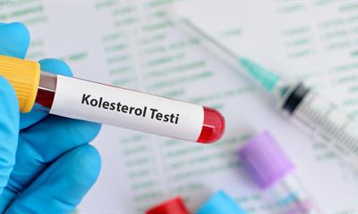 kolesterol testi